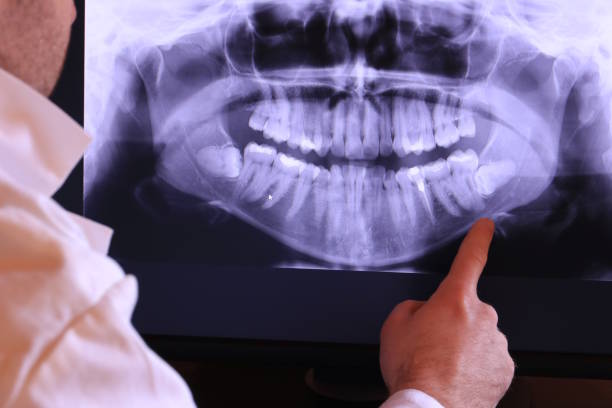 Best Broken or Chipped Tooth Repair in Rosedale, LA